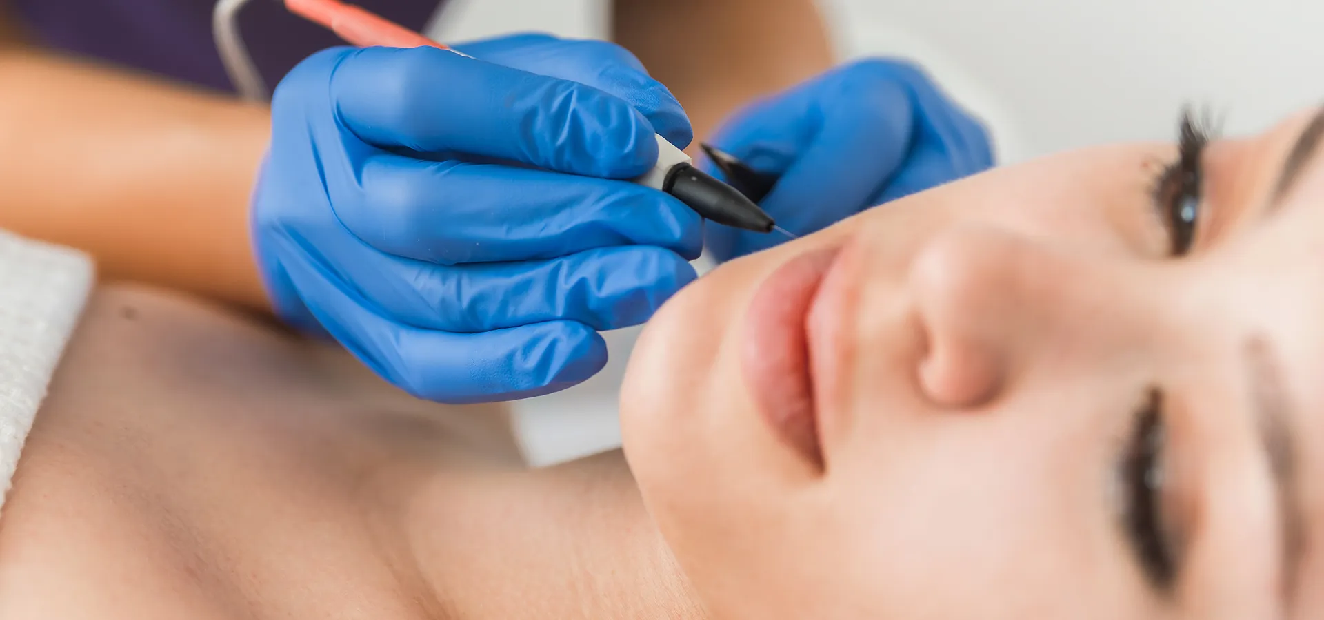 Femme qui se fait épiler par électrolyse sur le visage