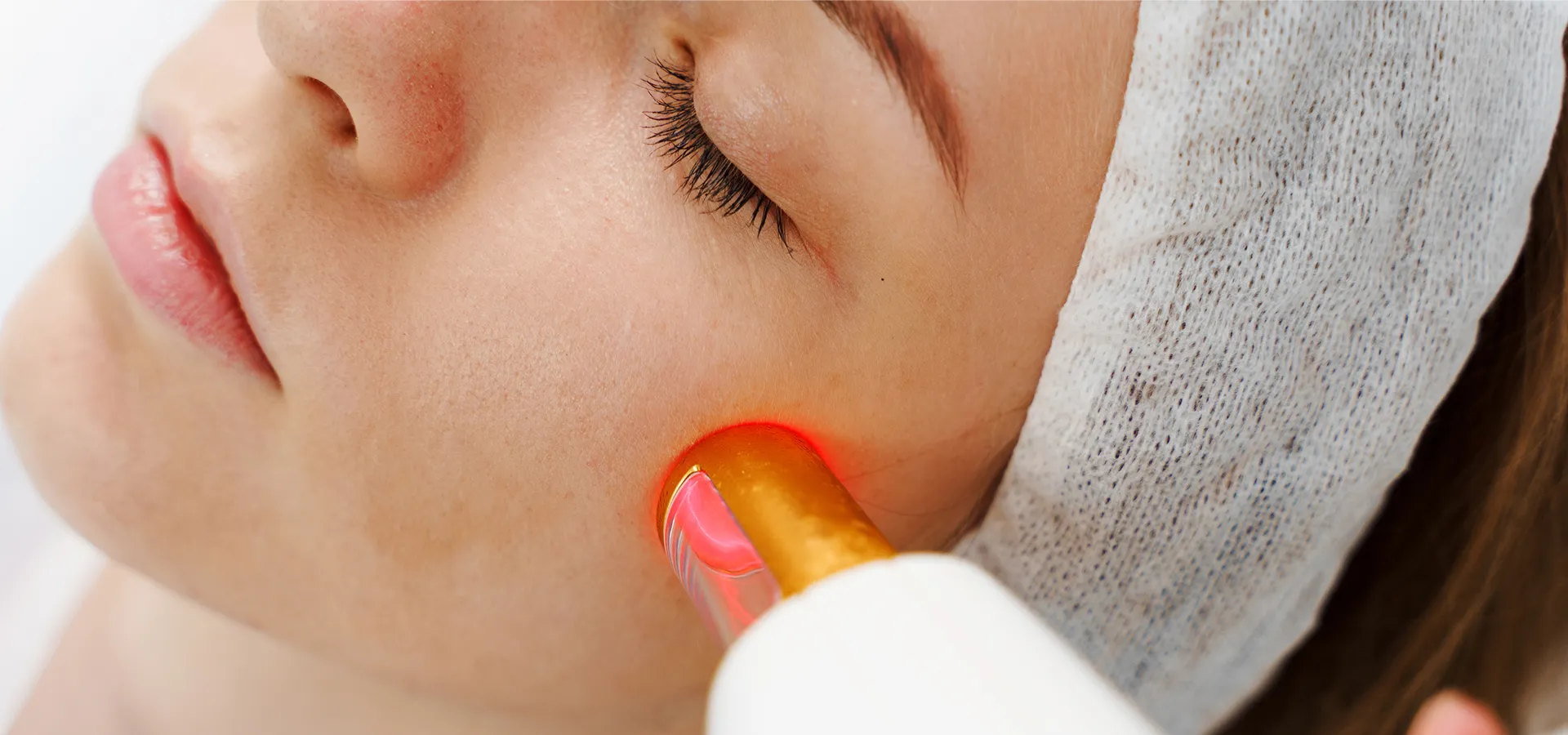 Femme recevant un traitement pour des imperfections cutanées sur le visage