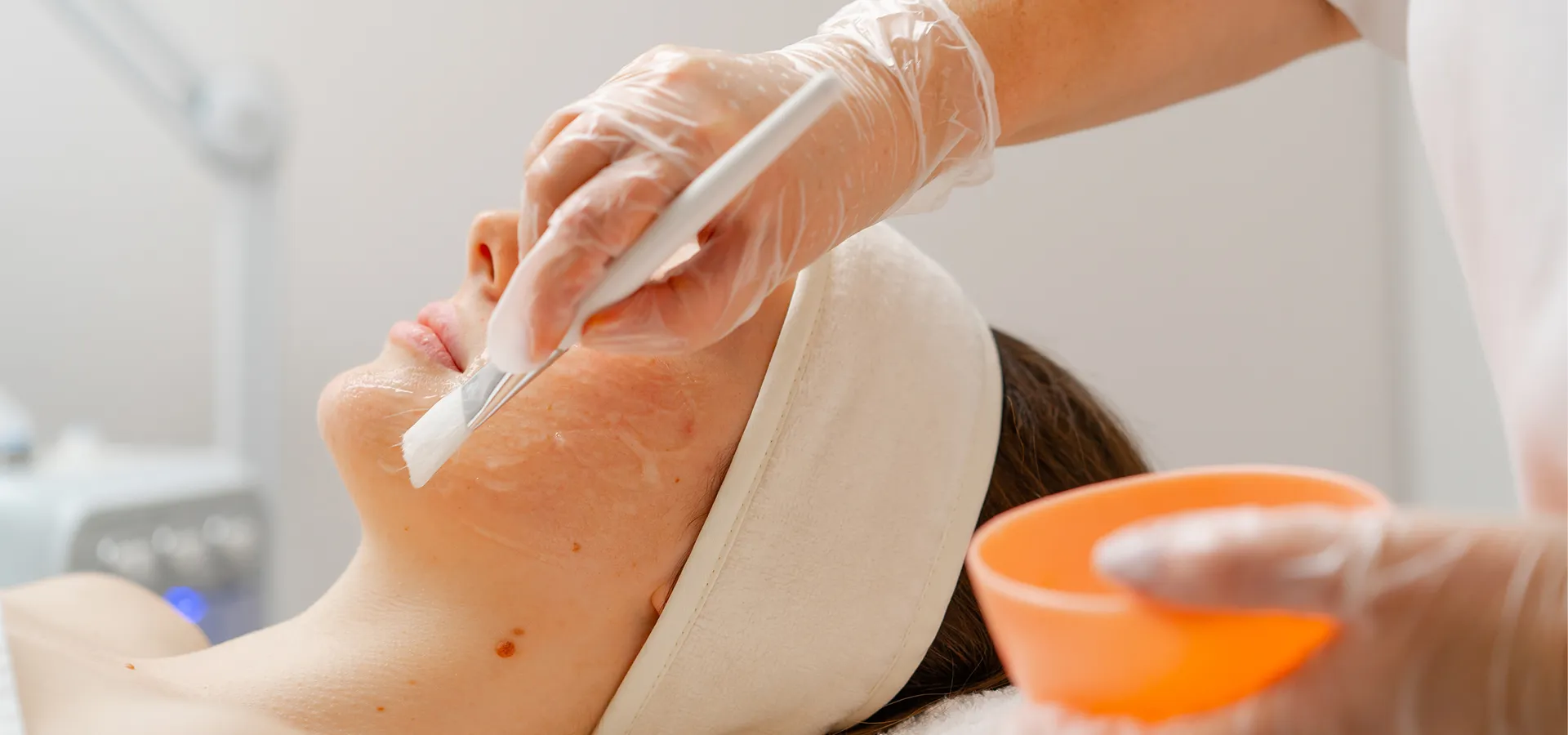 Femme se faisant exfolier le visage avec un peeling chimique doux