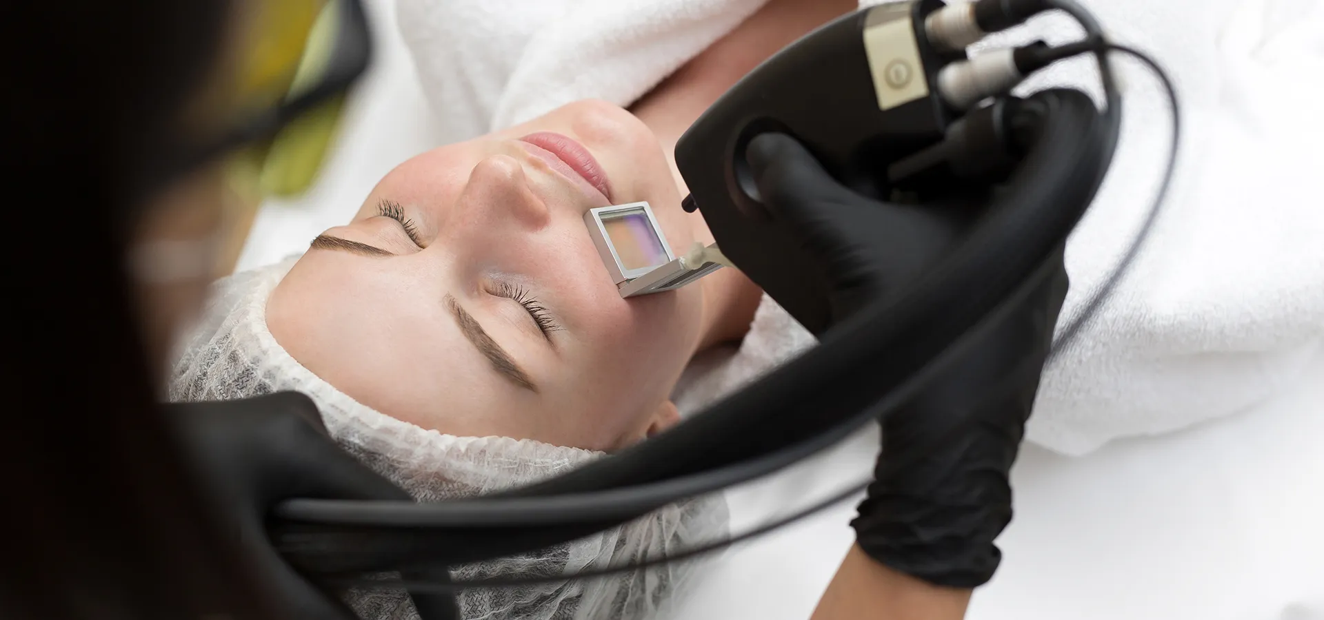 traitement-rougeur-rosacee-couperose