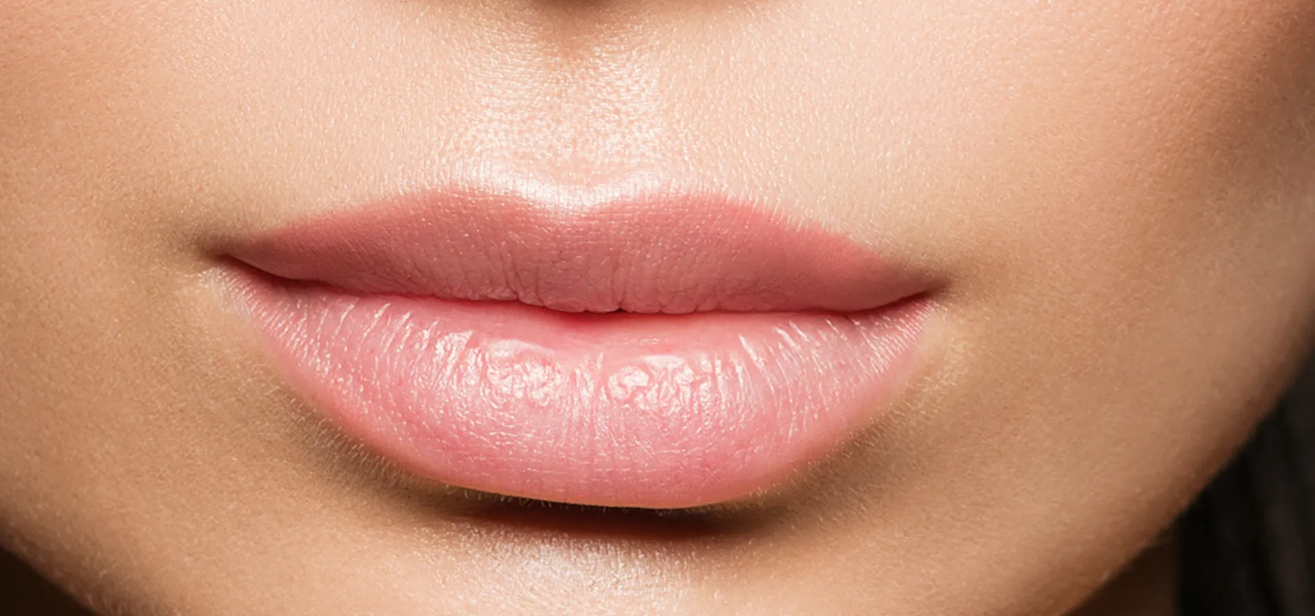 Femme aillant reçu un traitement de repulpage des lèvres sans injection